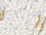 Phospho-PERK (Ser1096) Antibody in Immunohistochemistry (Paraffin) (IHC (P))