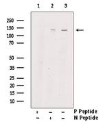 Phospho-PERK (Ser1096) Antibody in Western Blot (WB)