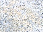 Phospho-DAPP1 (Tyr139) Antibody in Immunohistochemistry (Paraffin) (IHC (P))