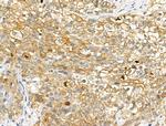 Phospho-GAB2 (Ser159) Antibody in Immunohistochemistry (Paraffin) (IHC (P))