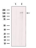 SOS1 Antibody in Western Blot (WB)