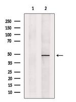 PSMC5 Antibody in Western Blot (WB)