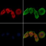 JAK1 Antibody in Immunocytochemistry (ICC/IF)