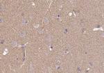 B3GAT1 Antibody in Immunohistochemistry (Paraffin) (IHC (P))