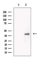 B3GAT1 Antibody in Western Blot (WB)