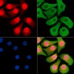 n-Myc Antibody in Immunocytochemistry (ICC/IF)