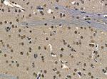 n-Myc Antibody in Immunohistochemistry (Paraffin) (IHC (P))