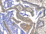 EDG2 Antibody in Immunohistochemistry (Paraffin) (IHC (P))