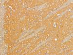 EDG2 Antibody in Immunohistochemistry (Paraffin) (IHC (P))