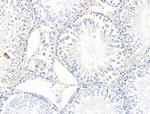 EDG2 Antibody in Immunohistochemistry (Paraffin) (IHC (P))