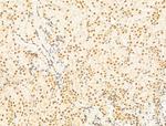 HDAC5 Antibody in Immunohistochemistry (Paraffin) (IHC (P))