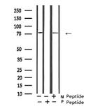 Phospho-GAB2 (Ser623) Antibody in Western Blot (WB)