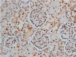 Phospho-MYPT1 (Thr853) Antibody in Immunohistochemistry (Paraffin) (IHC (P))