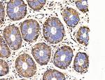 SIAH2 Antibody in Immunohistochemistry (Paraffin) (IHC (P))