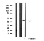 SIAH2 Antibody in Western Blot (WB)