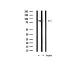 IKK alpha/beta Antibody in Western Blot (WB)