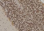 GATA3 Antibody in Immunohistochemistry (Paraffin) (IHC (P))