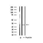 MARCKS Antibody in Western Blot (WB)