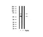 CaMKII beta/gamma/delta Antibody in Western Blot (WB)