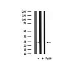 TIMP2 Antibody in Western Blot (WB)