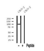 ROR1 Antibody in Western Blot (WB)