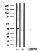 PRPS1 Antibody in Western Blot (WB)