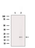 Phospho-SKP1 (Thr131) Antibody in Western Blot (WB)