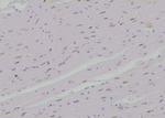 Phospho-SKI (Ser383) Antibody in Immunohistochemistry (Paraffin) (IHC (P))