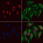 Phospho-HNF1A (Ser247) Antibody in Immunocytochemistry (ICC/IF)