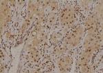 Phospho-HNF1A (Ser247) Antibody in Immunohistochemistry (Paraffin) (IHC (P))