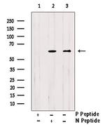 Phospho-HNF1A (Ser247) Antibody in Western Blot (WB)