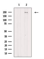 Phospho-NOTCH3 (Ser84) Antibody in Western Blot (WB)