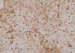 Phospho-NOTCH3 (Ser84) Antibody in Immunohistochemistry (Paraffin) (IHC (P))