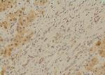 Phospho-SETD2 (Ser532) Antibody in Immunohistochemistry (Paraffin) (IHC (P))