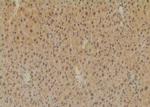 Phospho-SETD2 (Ser532) Antibody in Immunohistochemistry (Paraffin) (IHC (P))