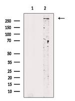 Phospho-SETD2 (Ser532) Antibody in Western Blot (WB)