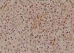 Phospho-SETD8 (Ser100) Antibody in Immunohistochemistry (Paraffin) (IHC (P))