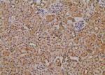 Phospho-NEK2 (Ser171) Antibody in Immunohistochemistry (Paraffin) (IHC (P))