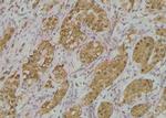 Phospho-ADAM9 (Thr761) Antibody in Immunohistochemistry (Paraffin) (IHC (P))