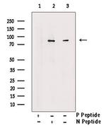 Phospho-PFKM (Ser74) Antibody in Western Blot (WB)