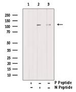 Phospho-GLI1 (Ser1071) Antibody in Western Blot (WB)