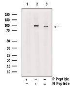 Phospho-LPIN1 (Thr14) Antibody in Western Blot (WB)