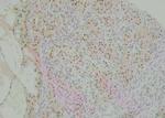 Phospho-Annexin A4 (Tyr255) Antibody in Immunohistochemistry (Paraffin) (IHC (P))