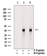 Phospho-Annexin A4 (Tyr255) Antibody in Western Blot (WB)