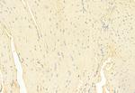 Phospho-RIP1 (Tyr384) Antibody in Immunohistochemistry (Paraffin) (IHC (P))