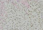 Phospho-BACH1 (Ser445) Antibody in Immunohistochemistry (Paraffin) (IHC (P))