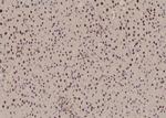 Phospho-BACH1 (Ser445) Antibody in Immunohistochemistry (Paraffin) (IHC (P))