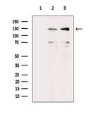 Phospho-SHIP2 (Tyr886) Antibody in Western Blot (WB)