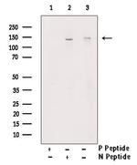 Phospho-SHIP2 (Tyr671) Antibody in Western Blot (WB)