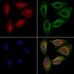 Phospho-TAK1 (Ser389) Antibody in Immunocytochemistry (ICC/IF)